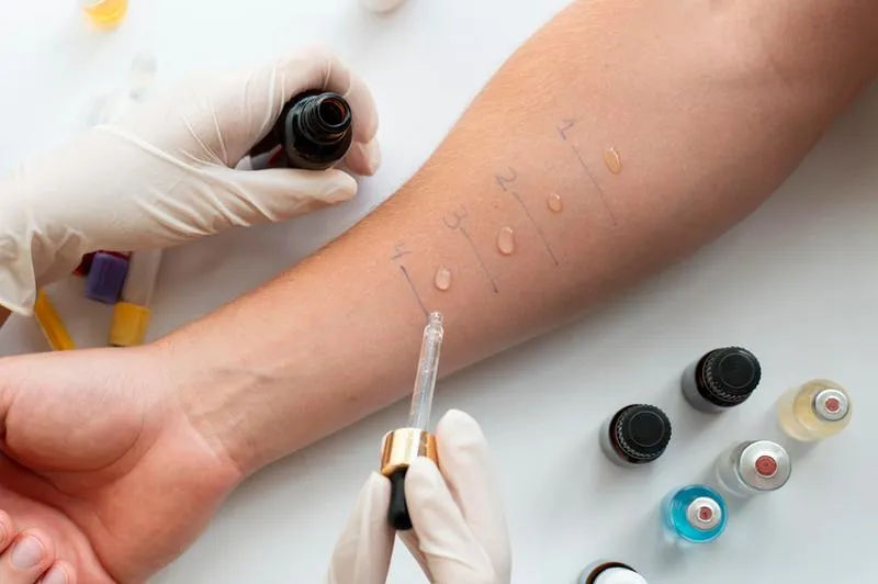 Diagnostyka alergii Lublin
